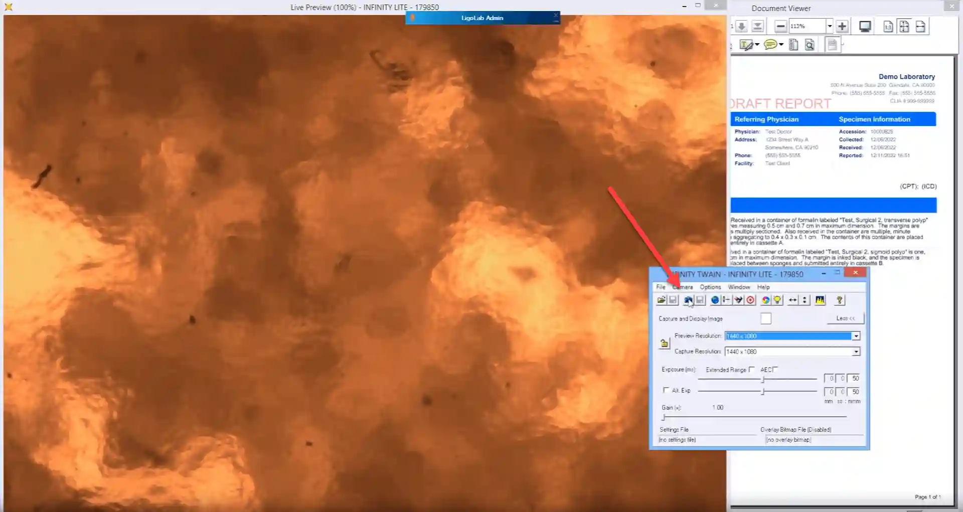 Anatomic Pathology Software Roundtable Recap: Balancing Pressures with the Promise of New Technology 